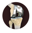 banner_knee_joint_replacement_img
